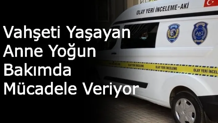 Vahşeti Yaşayan Anne Yoğun Bakımda Mücadele Veriyor