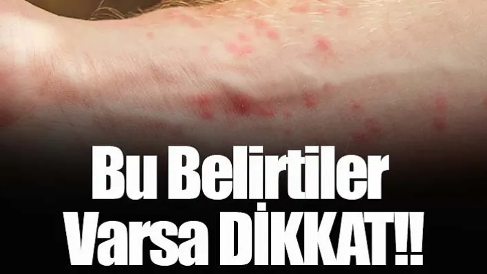 Bu belirtiler varsa DİKKAT!!