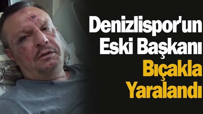 Denizlispor'un eski Başkanı bıçaklı kavgada yaralandı