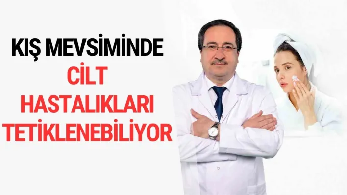 Kış mevsiminde cilt hastalıkları tetiklenebiliyor